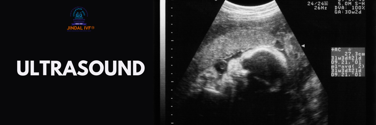 Ultrasound