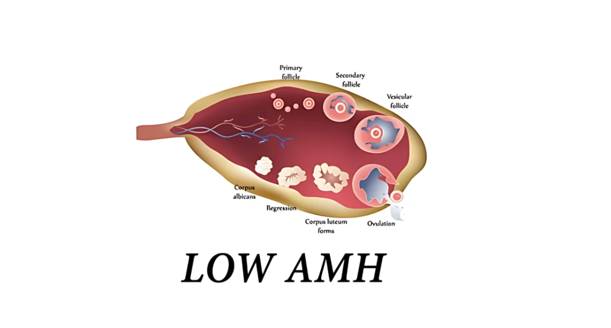 Low AMH and Pregnancy: Can You Get Pregnant With Low AMH?